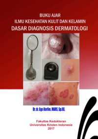 Image of Ebook : BUKU AJAR ILMU KESEHATAN KULIT DAN KELAMIN DASAR DIAGNOSIS DERMATOLOGI