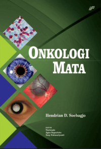Image of Ebook : Onkologi Mata
